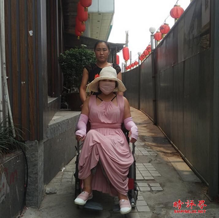 中国整形第一人“红粉宝宝” 30多次手术后面临乳房切除